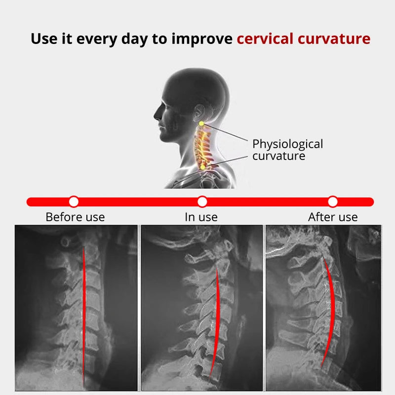 Cervial Neck Massager™